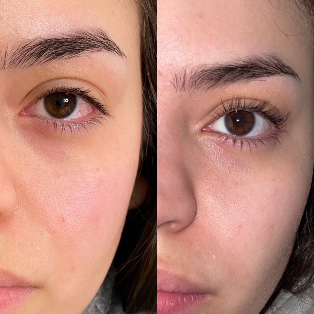 CEJAS OTRA VEZ, REGENERACIÓN BIOME