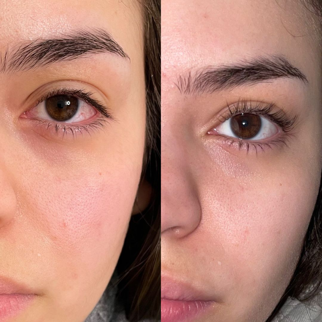 CEJAS OTRA VEZ, REGENERACIÓN BIOME