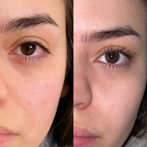 CEJAS OTRA VEZ, REGENERACIÓN BIOME