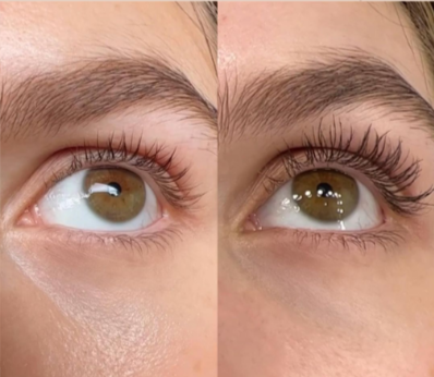 CEJAS OTRA VEZ, REGENERACIÓN BIOME